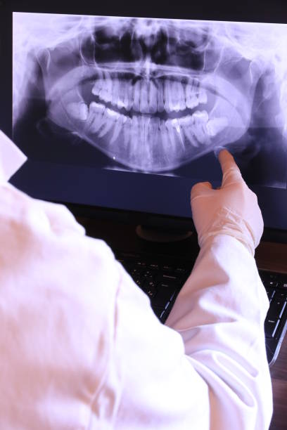 Best Broken or Chipped Tooth Repair in Earlimart, CA